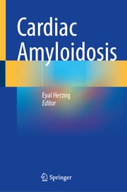 Cover von Cardiac Amyloidosis