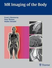 Cover von Whole Body MR Imaging