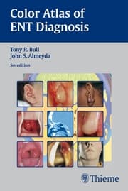 Cover von Color Atlas of ENT Diagnosis