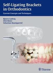 Cover von Self-ligating Brackets in Orthodontics