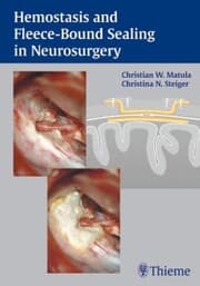 Cover von Hemostasis and Fleece-Bound Sealing in Neurosurgery