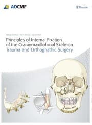 Cover von Principles of Internal Fixation of the Craniomaxillofacial Skeleton