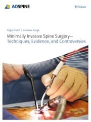 Cover von Minimally Invasive Spine Surgery - Techniques, Evidence, and Controversies