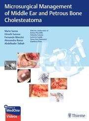 Cover von Microsurgical Management of Middle Ear and Petrous Bone Cholesteatoma