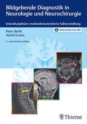 Cover von Bildgebende Diagnostik in Neurologie und Neurochirurgie