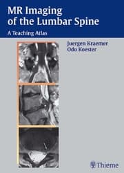 Cover von MR Imaging of the Lumbar Spine