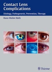 Cover von Contact Lens Complications
