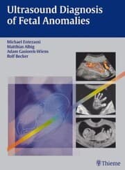 Cover von Ultrasound Diagnosis of Fetal Anomalies