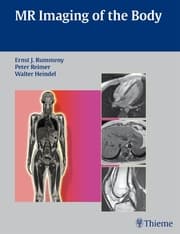 Cover von MR Imaging of the Body
