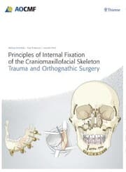 Cover von Principles of Internal Fixation of the Craniomaxillofacial Skeleton