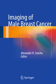 Cover von Imaging of Male Breast Cancer