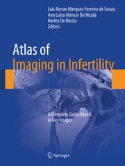 Cover von Atlas of Imaging in Infertility