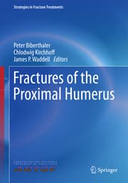 Cover von Fractures of the Proximal Humerus