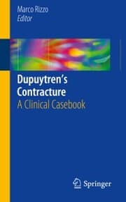 Cover von Dupuytren's Contracture