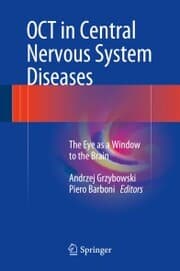 Cover von OCT in Central Nervous System Diseases