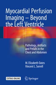 Cover von Myocardial Perfusion Imaging - Beyond the Left Ventricle