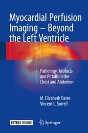 Cover von Myocardial Perfusion Imaging - Beyond the Left Ventricle