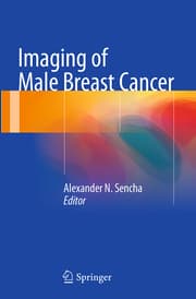 Cover von Imaging of Male Breast Cancer