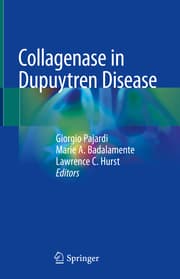 Cover von Collagenase in Dupuytren Disease