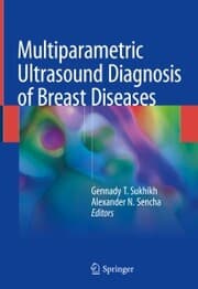 Cover von Multiparametric Ultrasound Diagnosis of Breast Diseases
