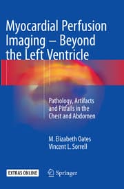 Cover von Myocardial Perfusion Imaging - Beyond the Left Ventricle
