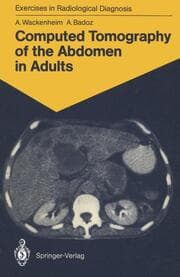 Cover von Computed Tomography of the Abdomen in Adults