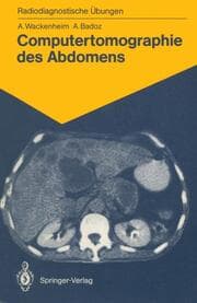 Cover von Computertomographie des Abdomens