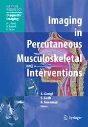 Cover von Imaging in Percutaneous Musculoskeletal Interventions