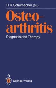 Cover von Osteoarthritis