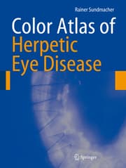 Cover von Color Atlas of Herpetic Eye Disease