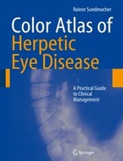 Cover von Color Atlas of Herpetic Eye Disease