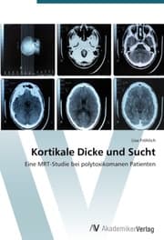 Cover von Kortikale Dicke und Sucht