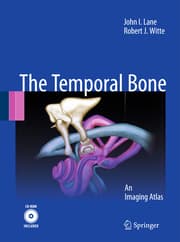 Cover von Temporal Bone