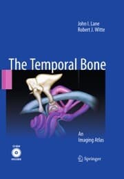 Cover von Temporal Bone