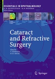 Cover von Cataract and Refractive Surgery