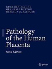 Cover von Pathology of the Human Placenta