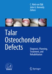 Cover von Talar Osteochondral Defects