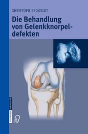 Cover von Die Behandlung von Gelenkknorpeldefekten