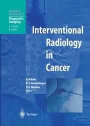 Cover von Interventional Radiology in Cancer