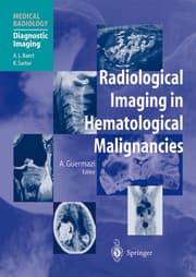 Cover von Radiological Imaging in Hematological Malignancies