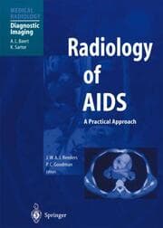 Cover von Radiology of AIDS