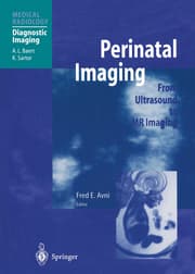 Cover von Perinatal Imaging