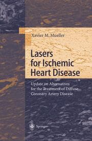 Cover von Lasers for Ischemic Heart Disease