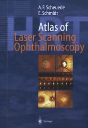 Cover von Atlas of Laser Scanning Ophthalmoscopy