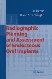 Cover von Radiographic Planning and Assessment of Endosseous Oral Implants