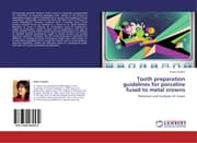 Cover von Tooth preparation guidelines for porceline fused to metal crowns