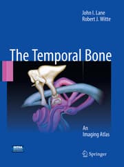 Cover von Temporal Bone