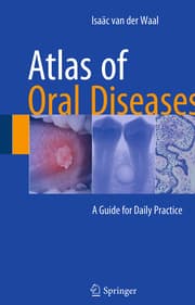 Cover von Atlas of Oral Diseases