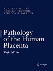 Cover von Pathology of the Human Placenta