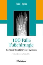 Cover von 100 Fälle Fußchirurgie